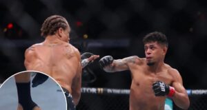 เหตุการณ์แปลกที่ UFC 309: การแข่งขันเลื่อนเพราะเล็บเท้า