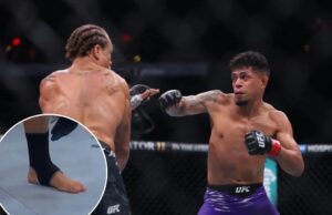 เหตุการณ์แปลกที่ UFC 309: การแข่งขันเลื่อนเพราะเล็บเท้า