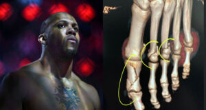 UFC 310: ดราม่าคะแนน-บาดเจ็บหนัก ซีริล กาน