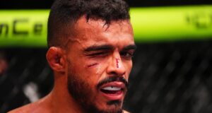อิสมาเอล บอนฟิม ถูกส่งโรงพยาบาลหลังพ่าย UFC 102